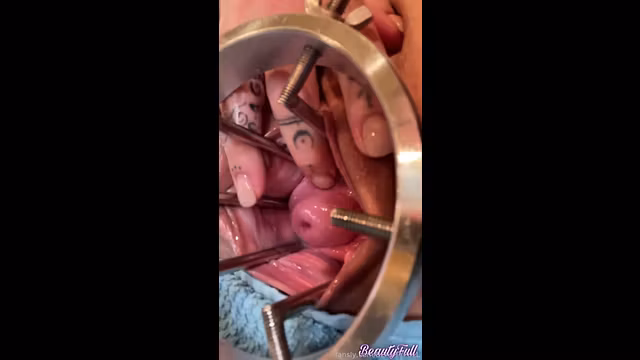 Exploring My Cervix