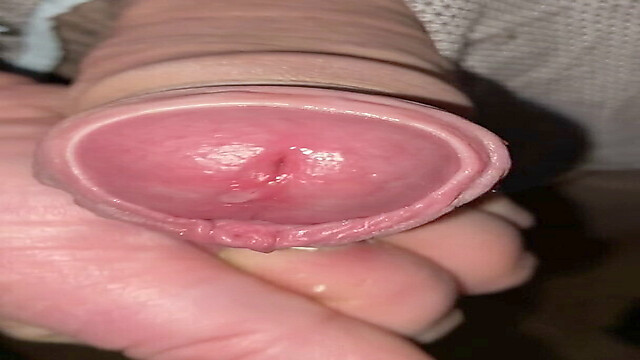 Foreskin1985