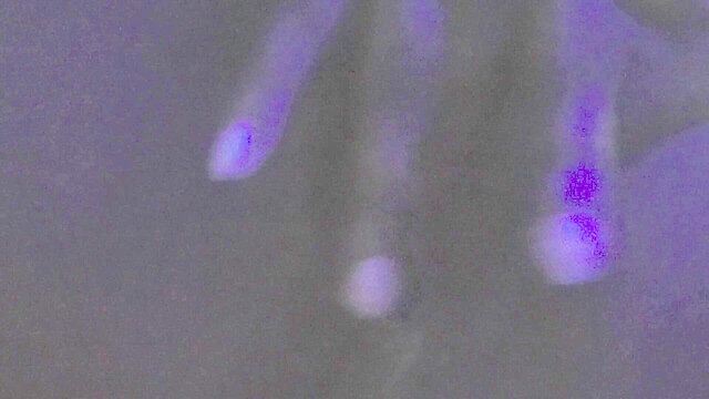 iu75-124934992
