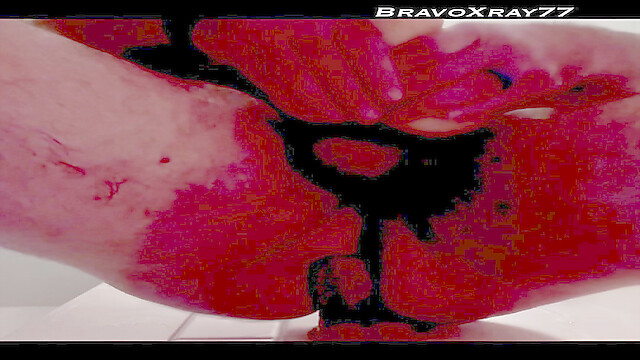 BravoXray7